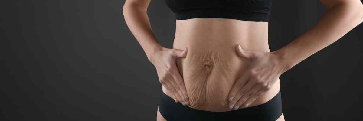 Karın Germe Estetiği tuzla