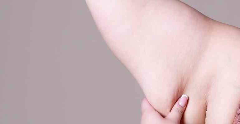 kol germe ameliyatı